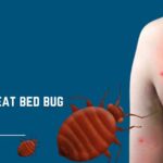 treat bed bug bites