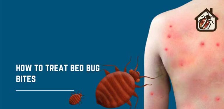 treat bed bug bites