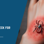 How to Check for Ticks