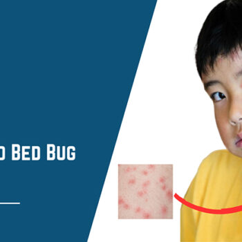 How Long Do Bed Bug Bites Last