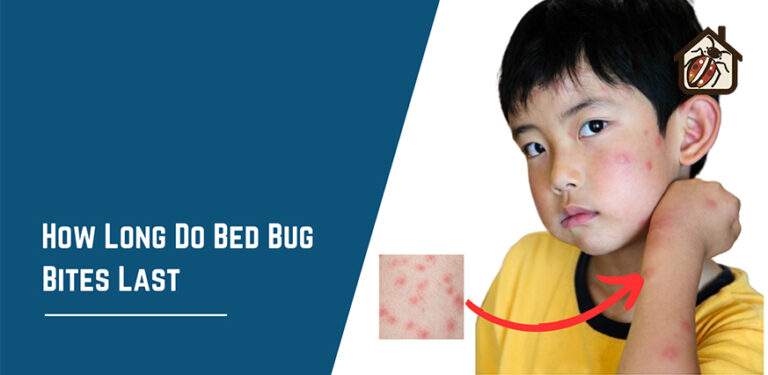 How Long Do Bed Bug Bites Last