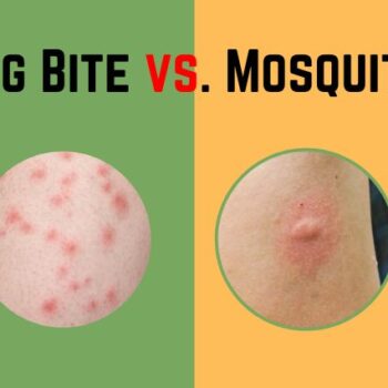 Bed Bug Bite vs. Mosquito Bite