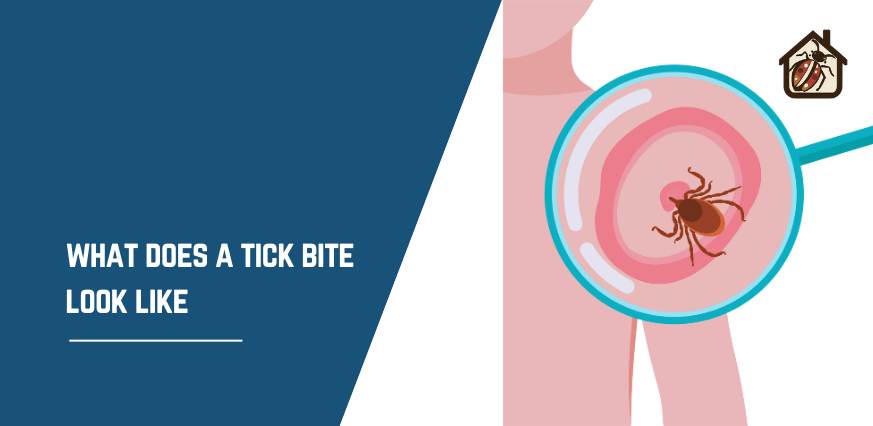 what does a tick bite look like