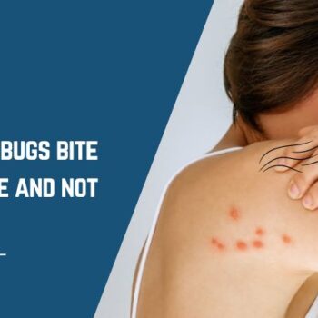 bed bugs bite some people and not others